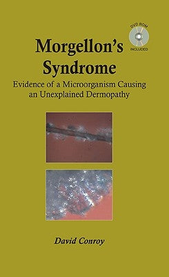 Morgellon's Syndrome by Conroy, David