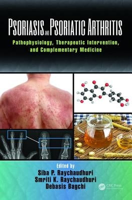 Psoriasis and Psoriatic Arthritis: Pathophysiology, Therapeutic Intervention, and Complementary Medicine by Raychaudhuri, Siba P.