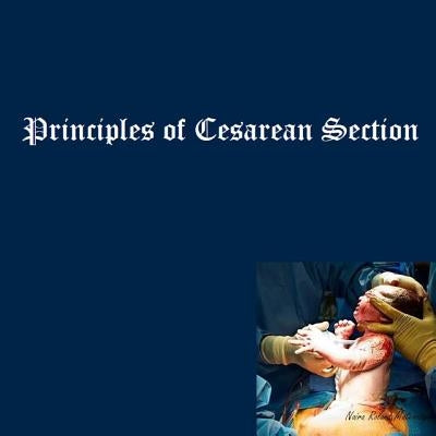 Principles of Cesarean Section by Matevosyan, Naira R.