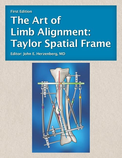 The Art of Limb Alignment: Taylor Spatial Frame by Herzenberg, John E.