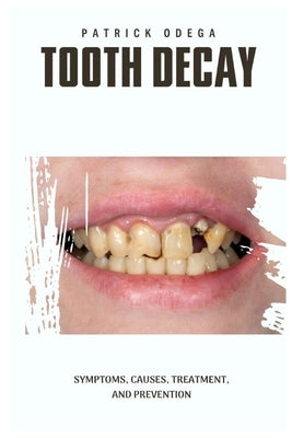 Tooth Decay: Symptoms, Causes, Treatment, and Prevention by Odega, Patrick