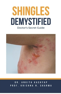 Shingles Demystified: Doctor's Secret Guide by Kashyap, Ankita