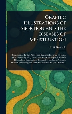 Graphic Illustrations of Abortion and the Diseases of Menstruation by Granville, A. B. (Augustus Bozzi)