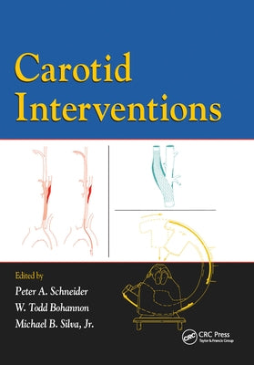 Carotid Interventions by Schneider, Peter