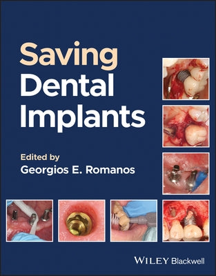 Saving Dental Implants by Romanos, Georgios E.
