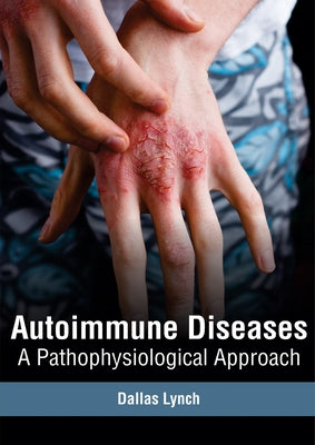 Autoimmune Diseases: A Pathophysiological Approach by Lynch, Dallas