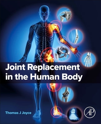 Joint Replacement in the Human Body by Joyce, Thomas J.