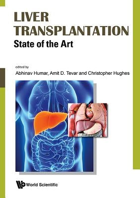 Liver Transplantation: State of the Art by Humar, Abhinav