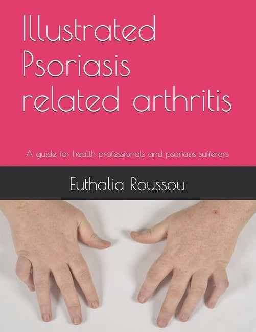 Illustrated Psoriasis related arthritis: A guide for health professionals and psoriasis sufferers by Roussou, Euthalia