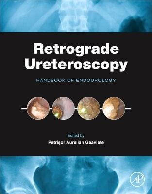 Retrograde Ureteroscopy: Handbook of Endourology by Geavlete, Petrisor Aurelian
