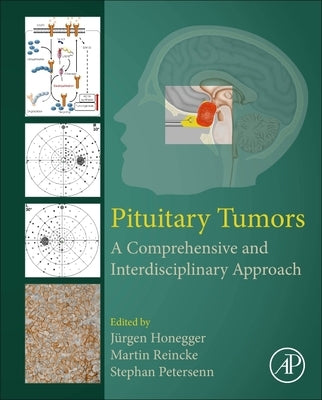 Pituitary Tumors: A Comprehensive and Interdisciplinary Approach by Honegger, Jürgen