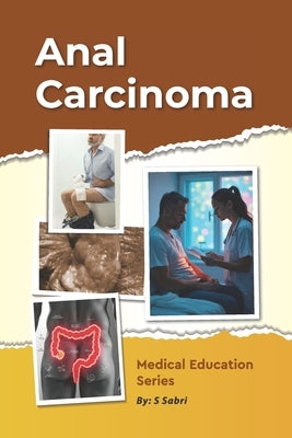 Anal Carcinoma by Sabri, S.