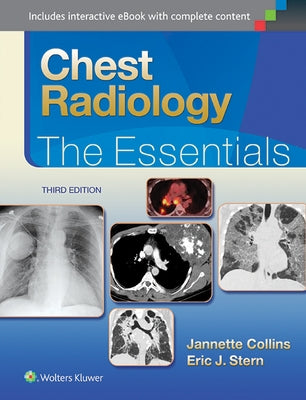 Chest Radiology: The Essentials by Collins, Janette
