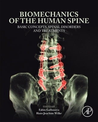 Biomechanics of the Human Spine: Basic Concepts, Spinal Disorders and Treatments by Galbusera, Fabio