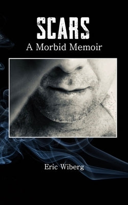 Scars: A Morbid Memoir by Wiberg, Eric