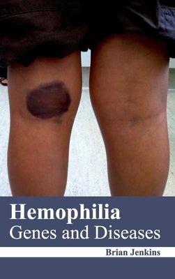 Hemophilia: Genes and Diseases by Jenkins, Brian