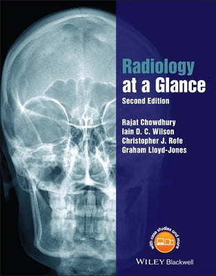 Radiology at a Glance by Chowdhury, Rajat