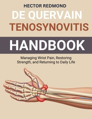 De Quervain Tenosynovitis Handbook: Managing Wrist Pain, Restoring Strength, and Returning to Daily Life by Redmond, Hector