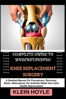 Complete Guide to Understanding Knee Replacement Surgery: A Detailed Manual On Procedures, Recovery, Risks, Alternatives For Arthritis Relief And Join by Hoyle, Klein