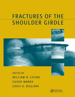 Fractures of the Shoulder Girdle by Levine, William N.