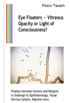 Eye Floaters - Vitreous Opacity or Light of Consciousness?: Floaters between Science and Religion, A challenge to Ophthalmology, Visual Nervous System by Tausin, Floco
