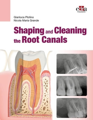 Shaping and Cleaning the Root Canals by Plotino Dds Phd, Gianluca