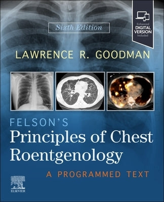 Felson's Principles of Chest Roentgenology: A Programmed Text by Goodman, Lawrence R.