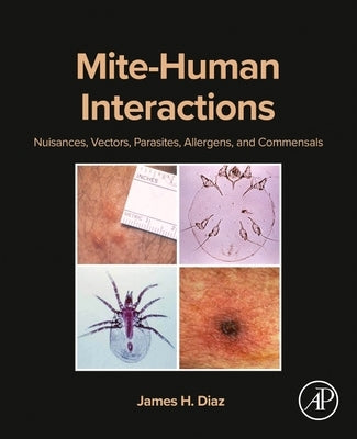 Mite-Human Interactions: Nuisances, Vectors, Parasites, Allergens, and Commensals by Diaz, James H.