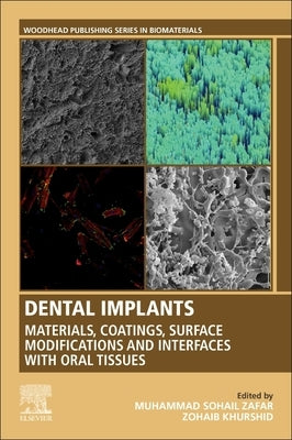 Dental Implants: Materials, Coatings, Surface Modifications and Interfaces with Oral Tissues by Zafar, Muhammad