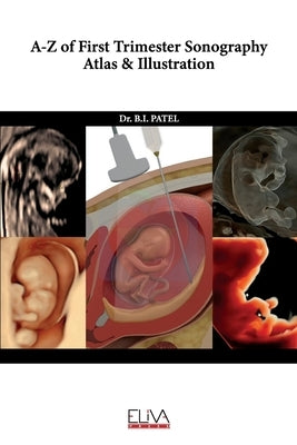 A-Z of First Trimester Sonography Atlas & Illustration by Patel, B. I.
