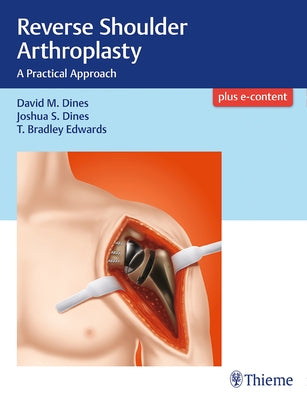 Reverse Shoulder Arthroplasty: A Practical Approach by Dines, David M.