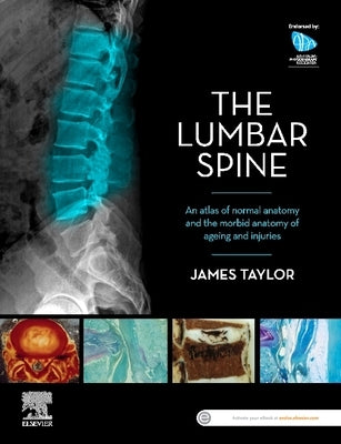 The Lumbar Spine: An Atlas of Normal Anatomy and the Morbid Anatomy of Ageing and Injury by Taylor, James