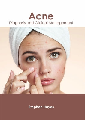 Acne: Diagnosis and Clinical Management by Hayes, Stephen