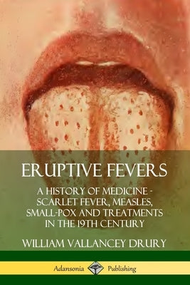 Eruptive Fevers: A History of Medicine - Scarlet Fever, Measles, Small-Pox and Treatments in the 19th Century by Drury, William Vallancey