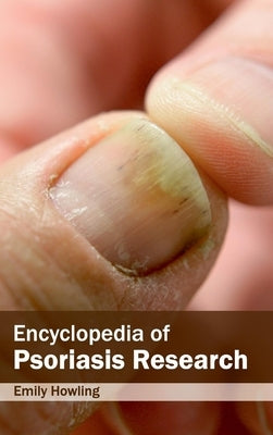 Encyclopedia of Psoriasis Research by Howling, Emily
