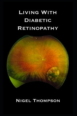 Living with Diabetic Retinopathy by Thompson, Nigel