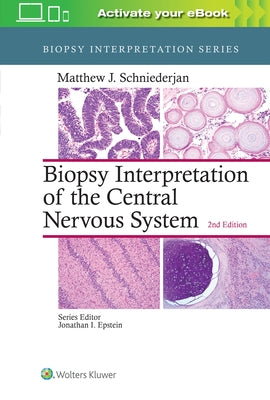 Biopsy Interpretation of the Central Nervous System by Schniederjan, Matthew J.