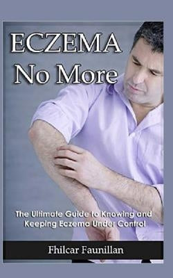 Eczema Cure: Eczema No More - The Ultimate Guide to Knowing and Keeping Eczema Under Control by Faunillan, Fhilcar