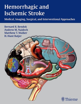 Hemorrhagic and Ischemic Stroke: Medical, Imaging, Surgical and Interventional Approaches [With Web Access] by Bendok, Bernard