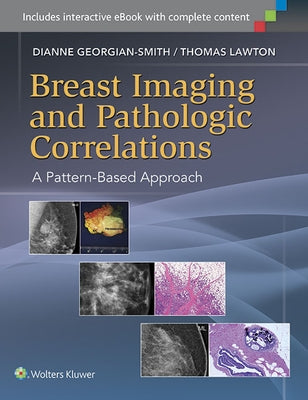 Breast Imaging and Pathologic Correlations: A Pattern-Based Approach by Georgian-Smith, Dianne