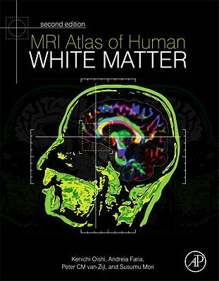 MRI Atlas of Human White Matter by Oishi, Kenichi
