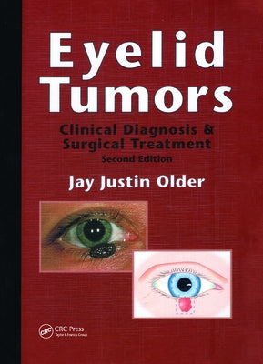 Eyelid Tumors by Older, Jay Justin