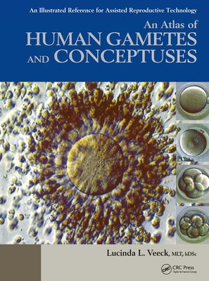 An Atlas of Human Gametes and Conceptuses: An Illustrated Reference for Assisted Reproductive Technology by Veeck, Lucinda L.