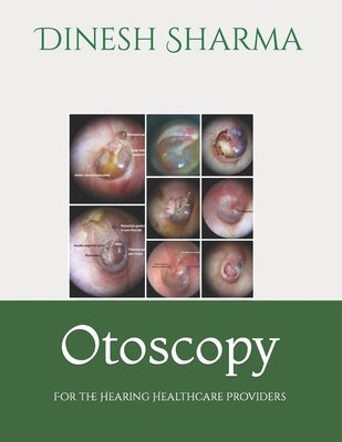 Otoscopy: For the Hearing Healthcare Provider by Sharma, Dinesh