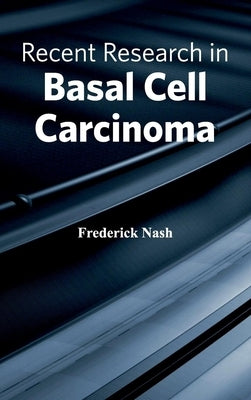 Recent Research in Basal Cell Carcinoma by Nash, Frederick