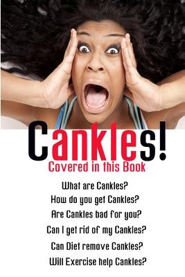 Cankles: This Guide will answer all of your Cankles questions by Rehor, Tony