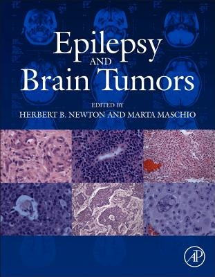 Epilepsy and Brain Tumors by Newton, Herbert B.