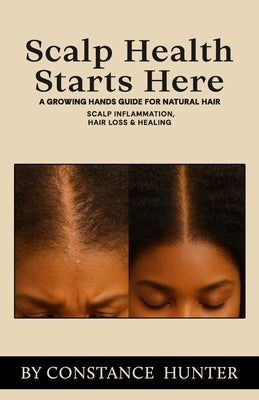 Scalp Health Starts Here: From Root to Tip: a Growing Hands Guide for Natural Hair by Hunter, Constance M.