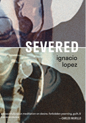 Severed by Lopez, Ignacio
