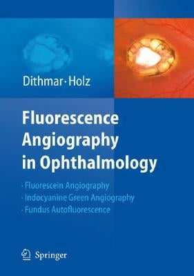 Fluorescence Angiography in Ophthalmology by Dithmar, Stefan